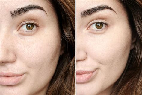 chanel foundations for oily skin|chanel foundation before and after.